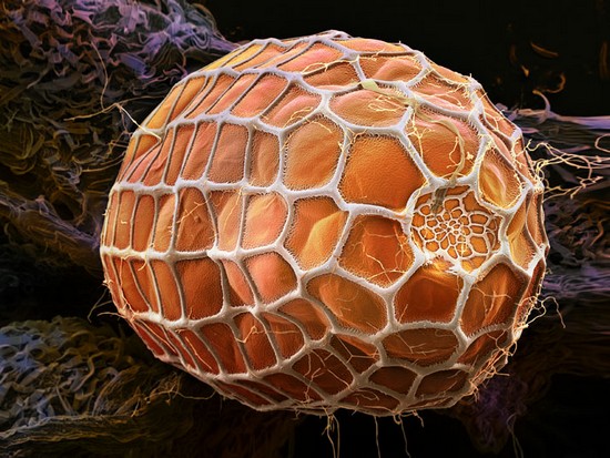 insect-eggs07.jpg