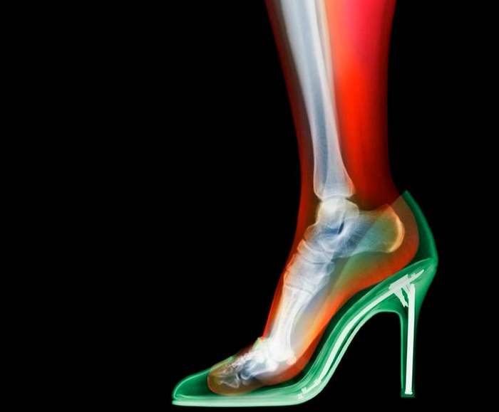 Nick Veasey рентгенография